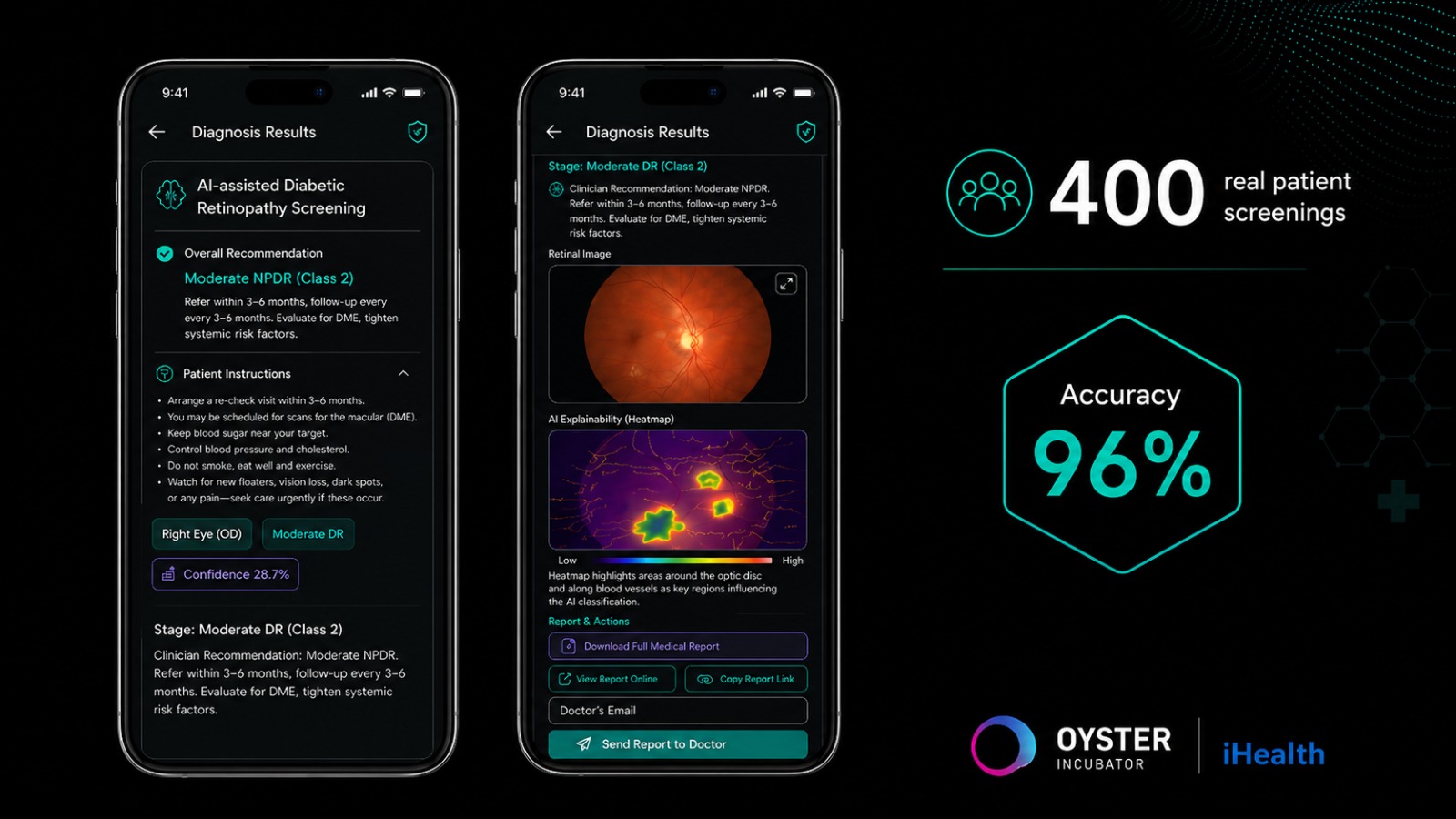 iHealth — 400 screenings, 96% accuracy