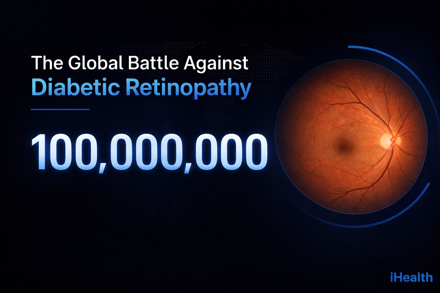 100 million people affected by diabetic retinopathy